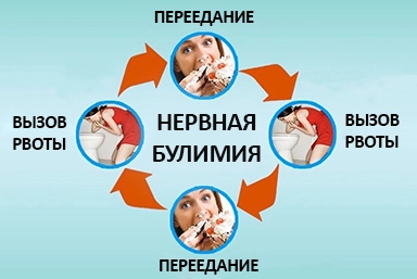 Лечение булимии в Родниковской